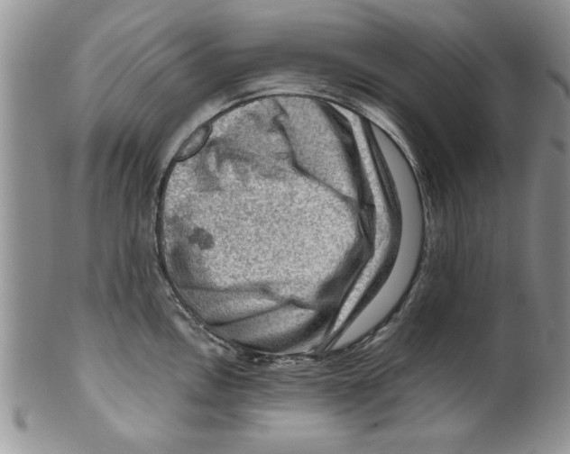 X0000099531146200806131122