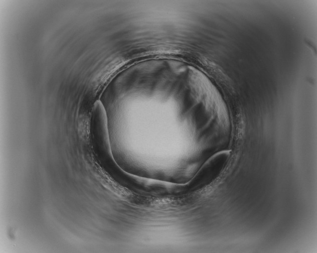 X0000099531169200806131121