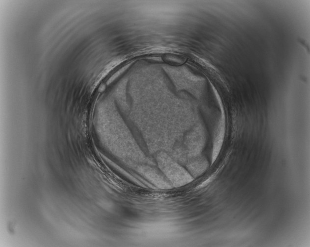 X0000099531170200806131121