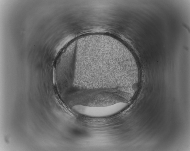 X0000099531171200806131121