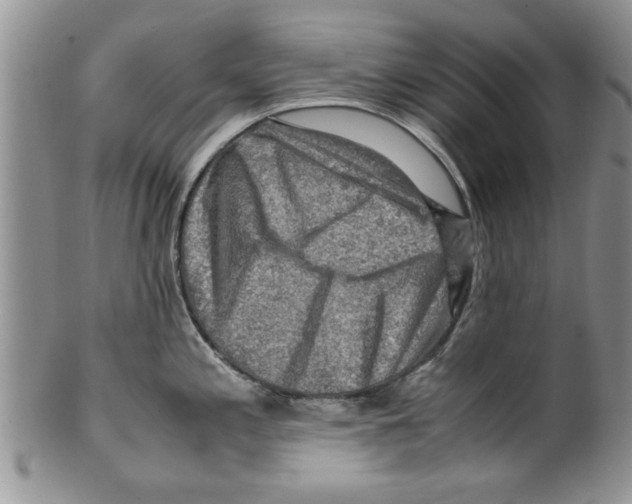 X0000099531197200806131120