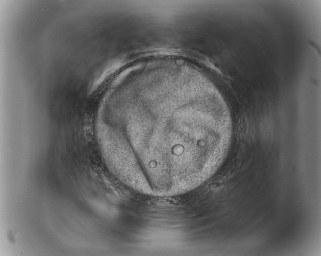 X0000099531255200806131120