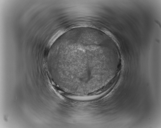 X0000099531385200806131118