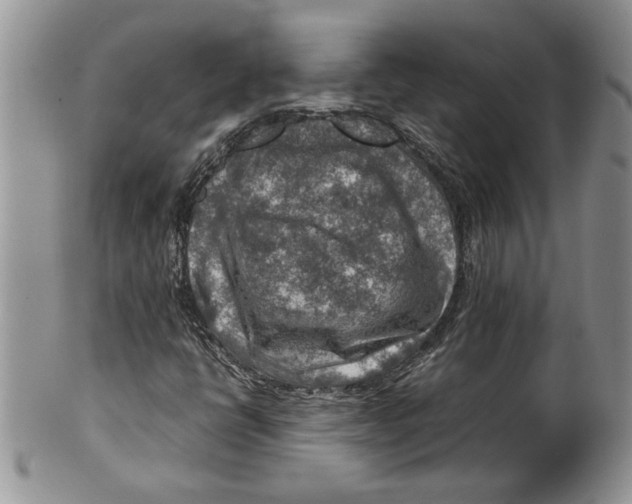 X0000099531398200806131117