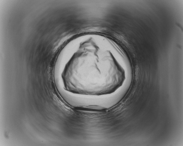 X0000099531404200806131117