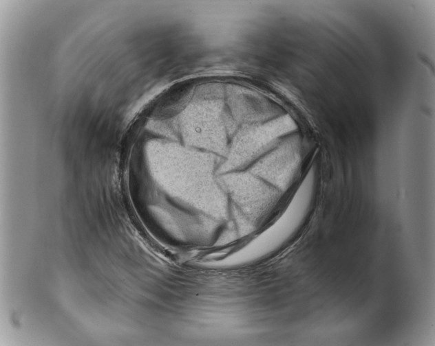 X0000099531452200806131117