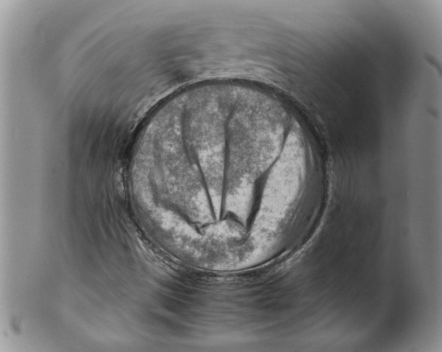 X0000099531497200806131116