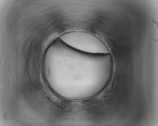 X0000099540145200805160757