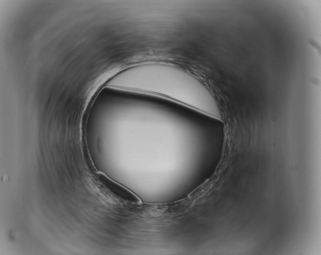 X0000099540148200805160757
