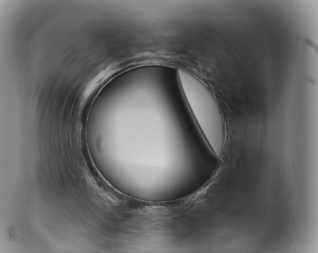 X0000099540150200805160757