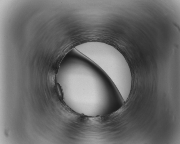 X0000099540188200805160757