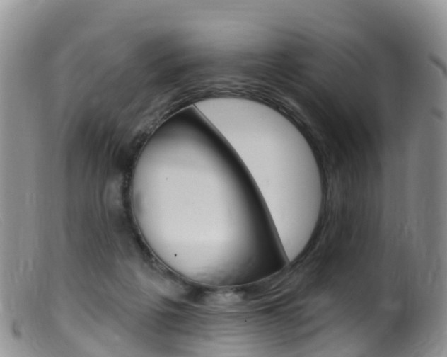 X0000099540217200805160756