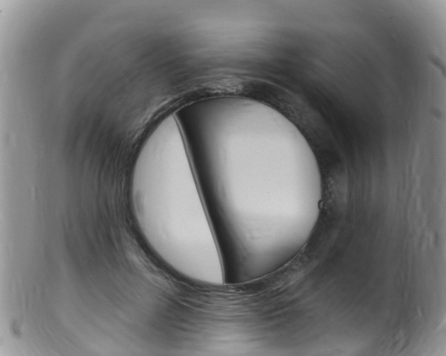 X0000099540600200805160750