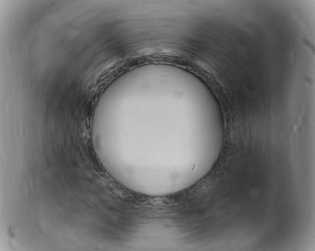 X0000099540966200805160745