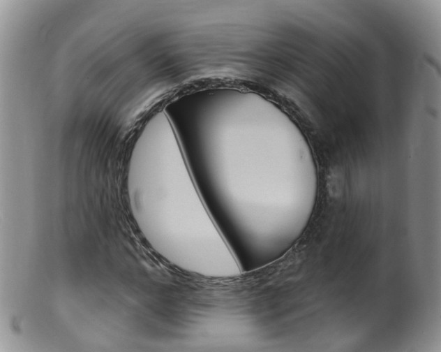 X0000099540968200805160745