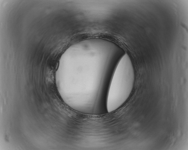 X0000099541204200805160740