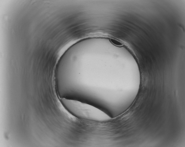 X0000099541387200805160738