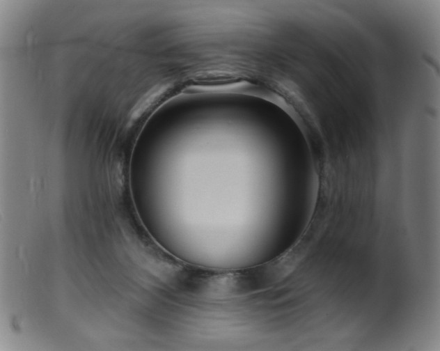 X0000099540116200805161437