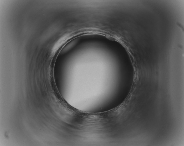 X0000099540151200805161436