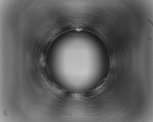 X0000099540187200805161436