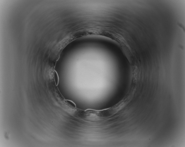 X0000099540285200805161435