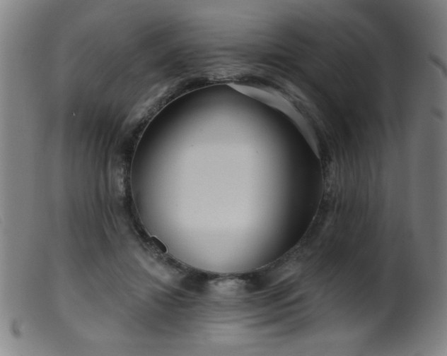 X0000099540452200805161432