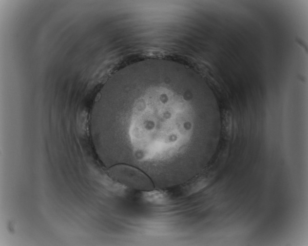 X0000099540511200805161431