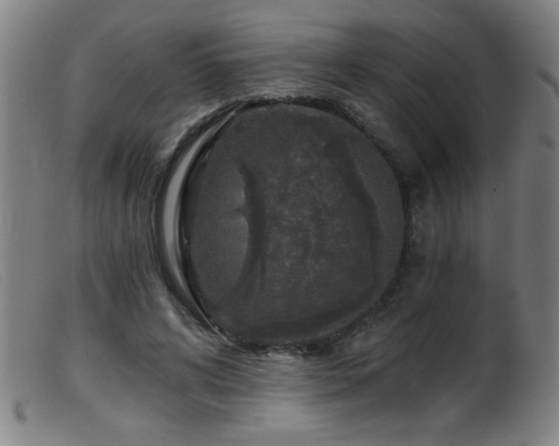 X0000099540592200805161429