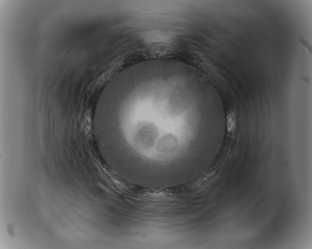 X0000099541011200805161422