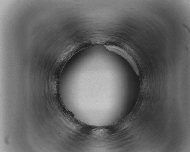 X0000099540452200805231131