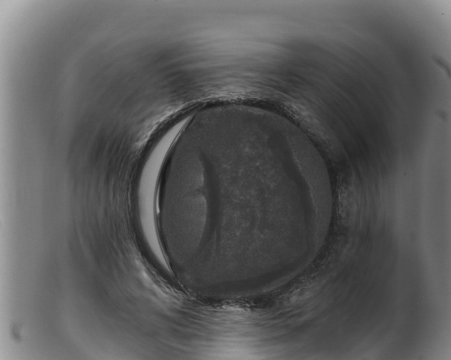 X0000099540592200805231129