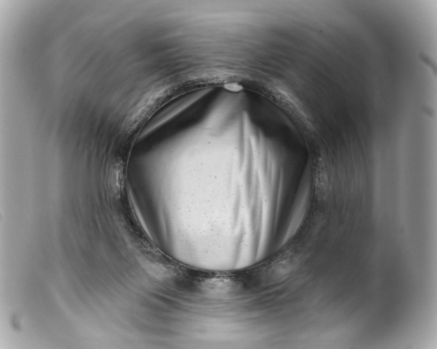 X0000099540119200805301508