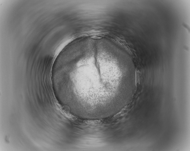 X0000099540147200805301507