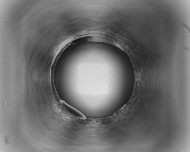 X0000099540148200805301507