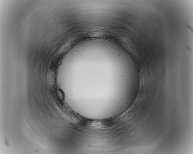 X0000099540171200805301508