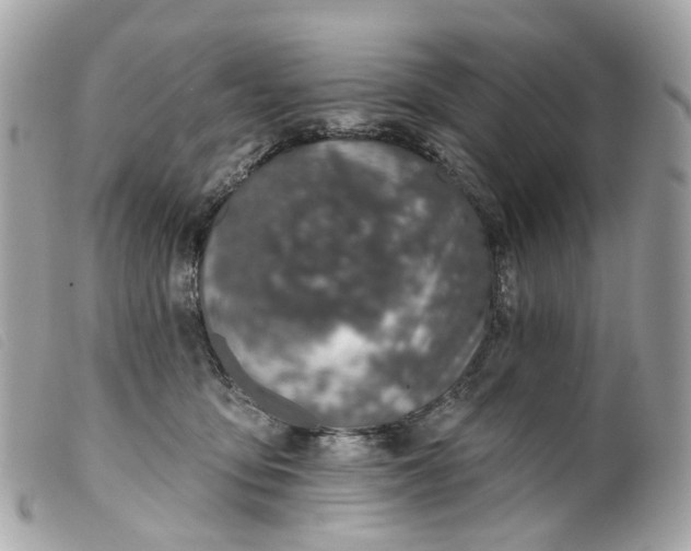 X0000099540419200805301504