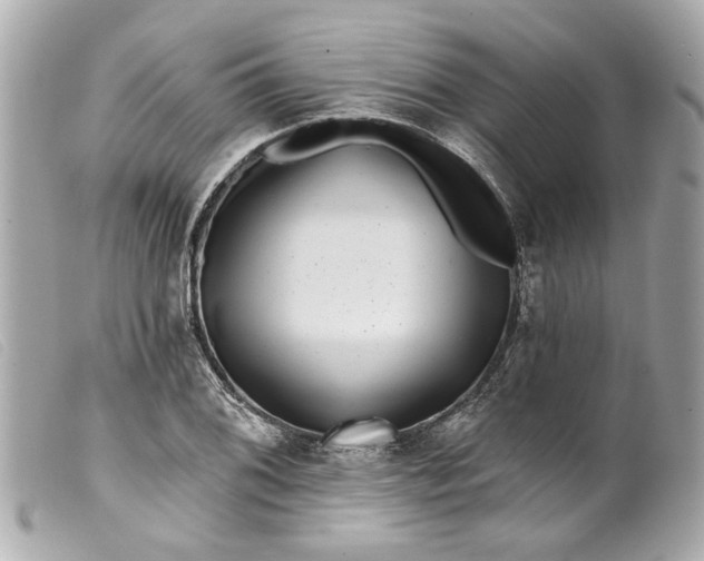 X0000099541076200805301456