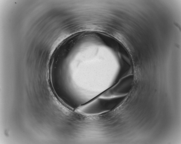 X0000099541136200805301455