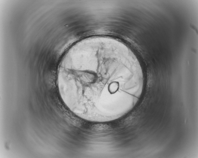 X0000099541314200805301452