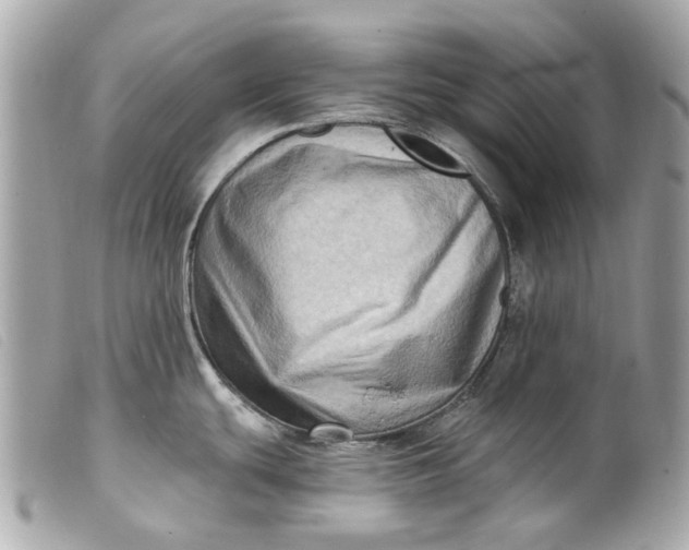 X0000099541439200805301451