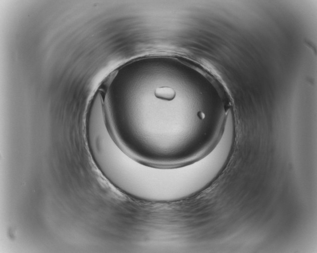 X0000099541480200805301450