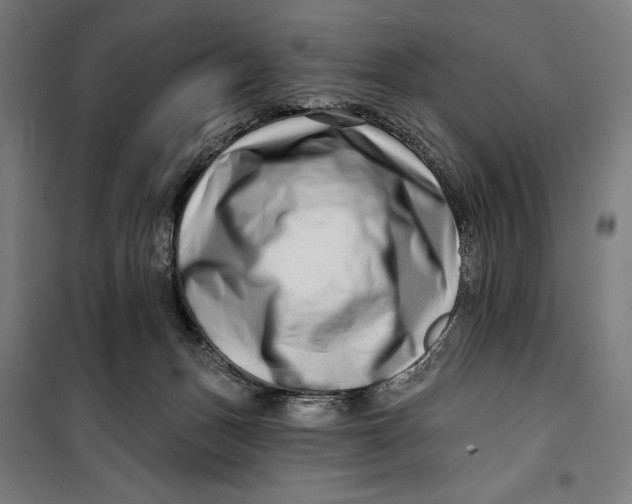 X0000099540175200806061502