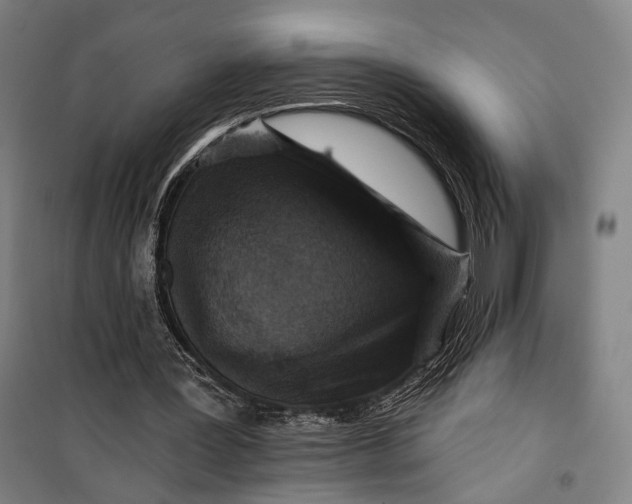 X0000099540387200806061459