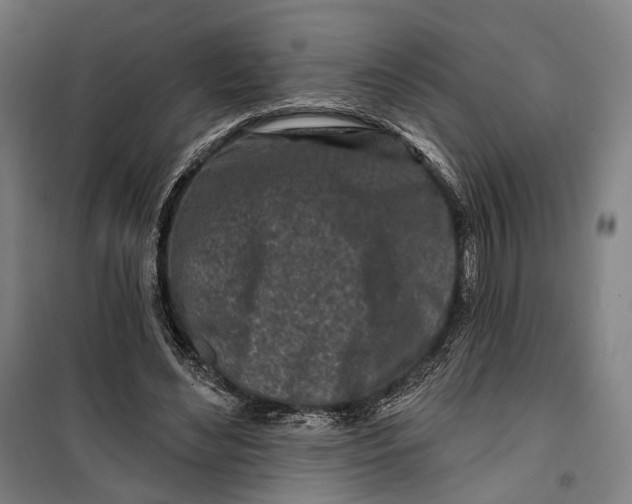 X0000099540492200806061457