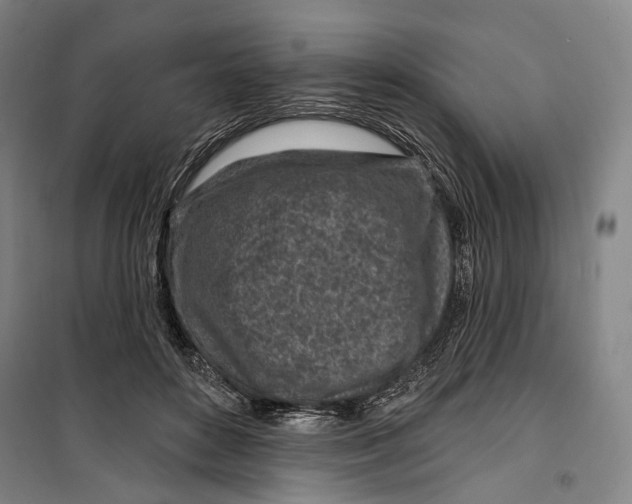 X0000099540504200806061457