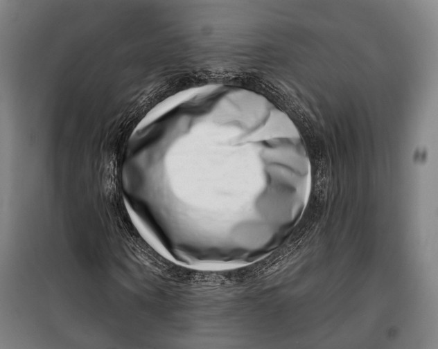 X0000099540866200806061452