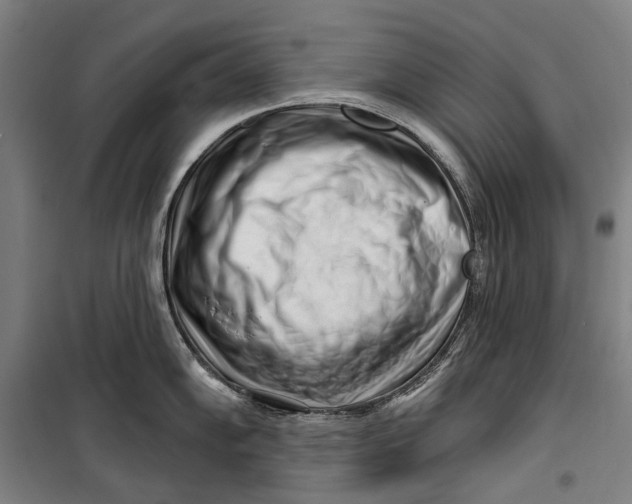 X0000099541102200806061449