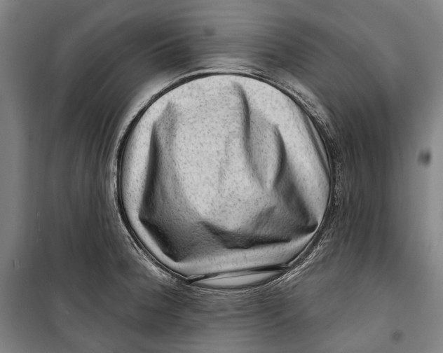 X0000099541188200806061448