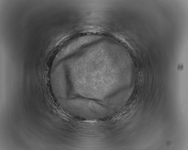 X0000099541399200806061444