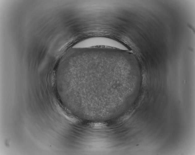 X0000099540165200806131157